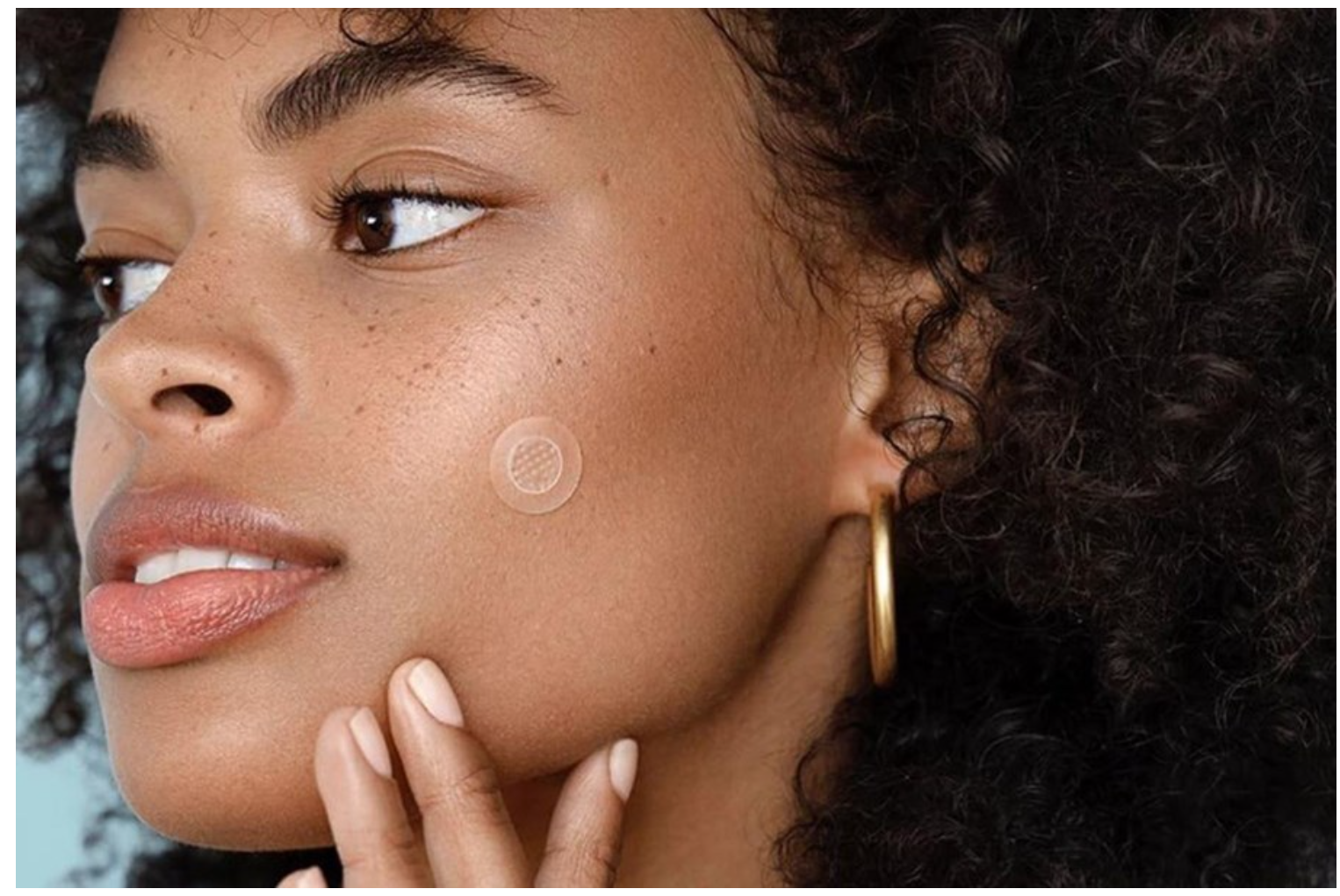 Heal Pimples With No No Skin From Radiancy